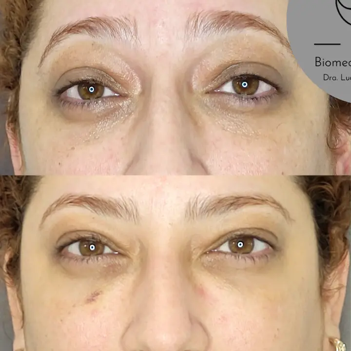 AnyConv.com__Facial-2