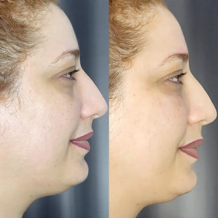 AnyConv.com__Facial-3