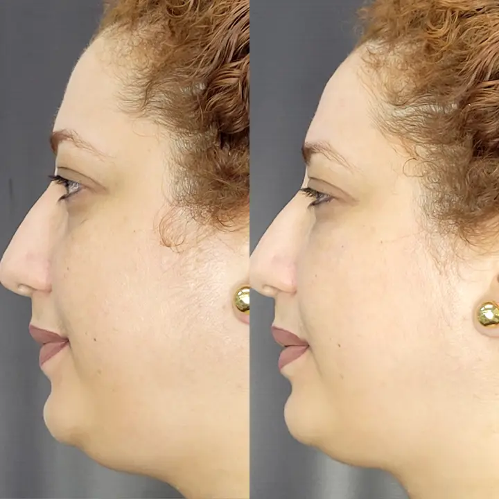 AnyConv.com__Facial-4