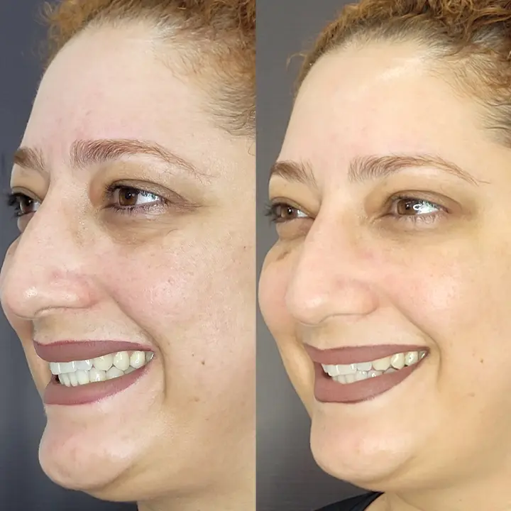 AnyConv.com__Facial-5