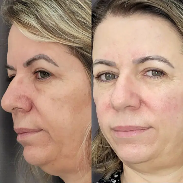 AnyConv.com__bioestimulador-1