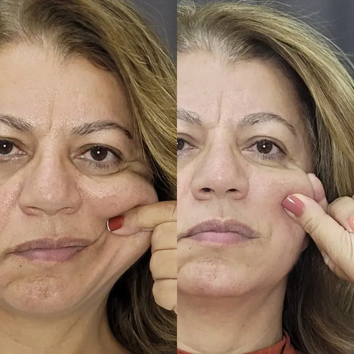 AnyConv.com__bioestimulador-2