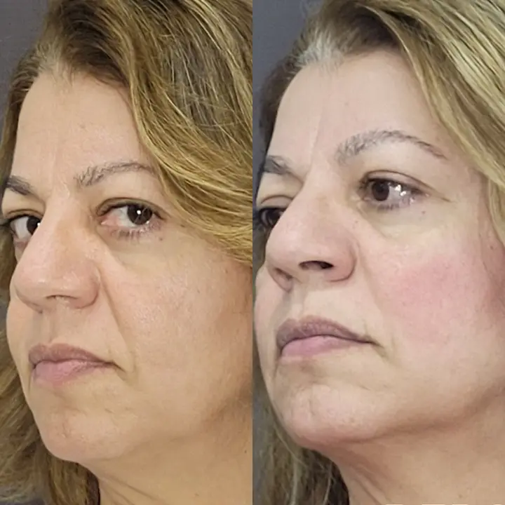 AnyConv.com__bioestimulador-3