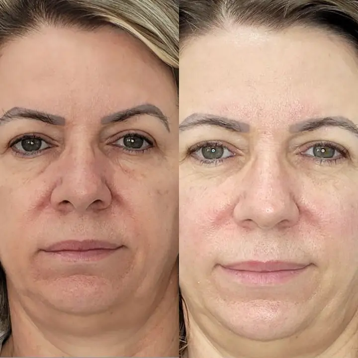 AnyConv.com__bioestimulador-4